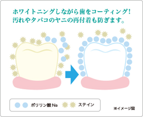 ポリリンプラチナホワイトニングはここが違います